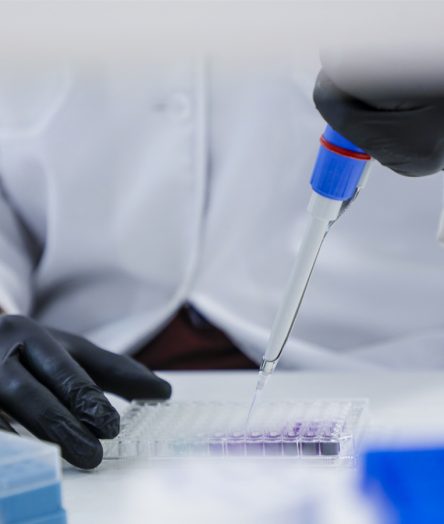 Scientist wearing gloves uses a pipette to dispense liquid into a clear 96-well microplate during an experiment.